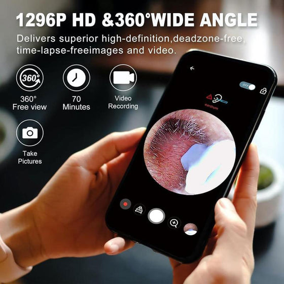 Smart visuell öronrensare med kamera