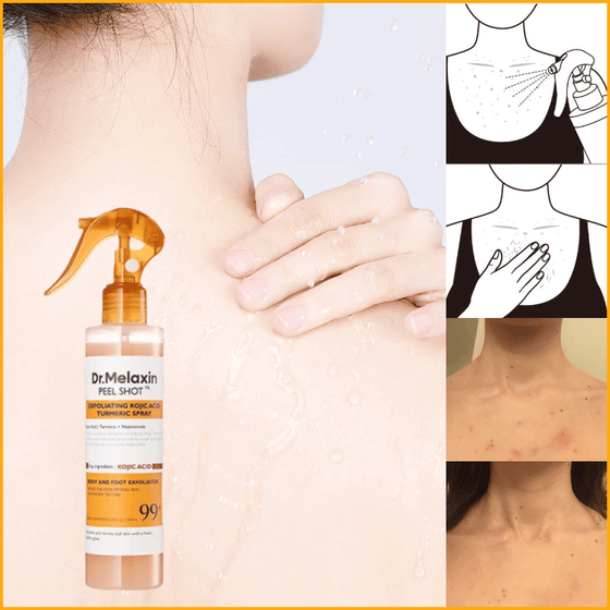 Keratin Care Kojic Acid Gurkmeja Spray