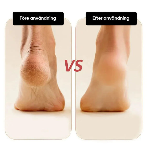 Elektrisk förhårdnadsfotslip