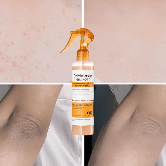Keratin Care Kojic Acid Gurkmeja Spray