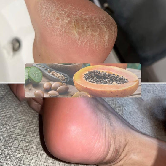 Exfolierande Fotmask