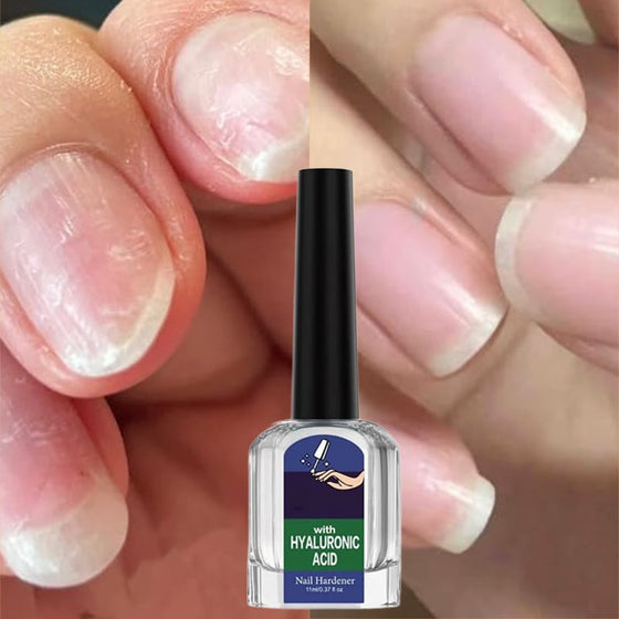 Lösning för svampdödande nagelreparation