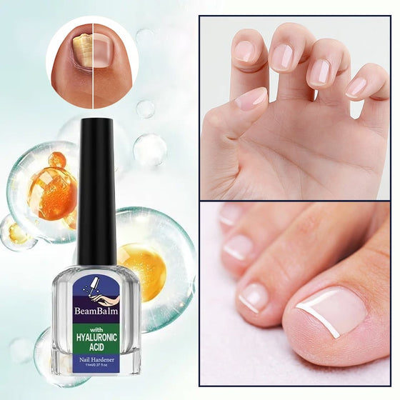 Lösning för svampdödande nagelreparation