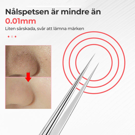 Professionella pincett för borttagning av pormaskar i ansiktet