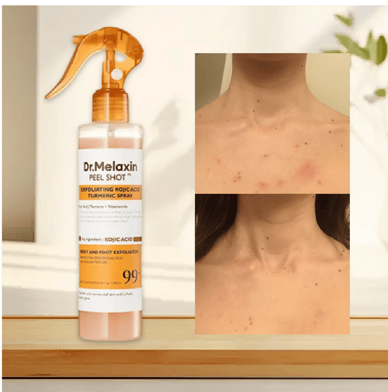 Keratin Care Kojic Acid Gurkmeja Spray