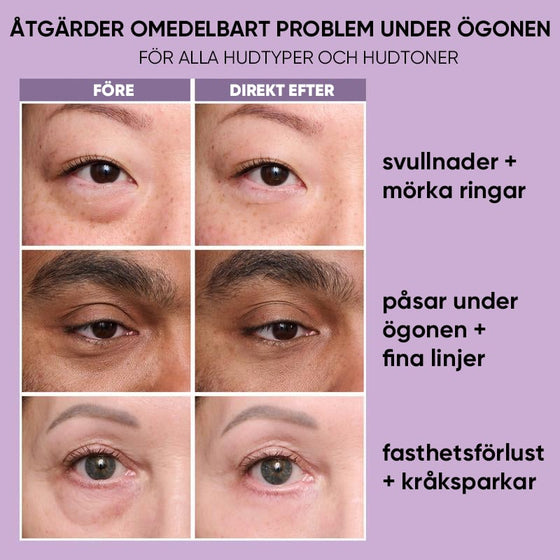 Lyftande och uppstramande ögonkräm