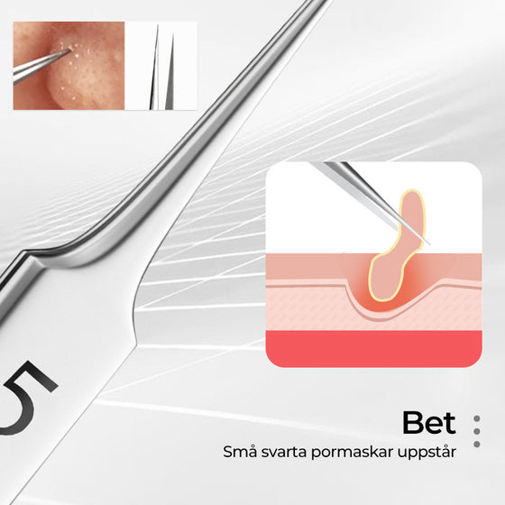 Professionella pincett för borttagning av pormaskar i ansiktet