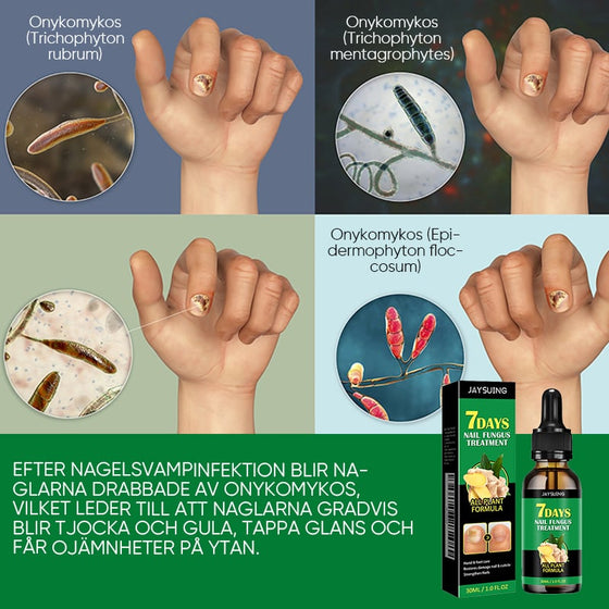 Ingefära Nagelbehandling