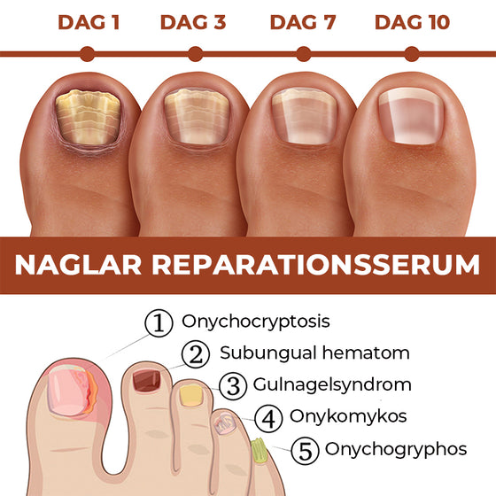 Serum för nageltillväxt och stärkande på 7 dagar.