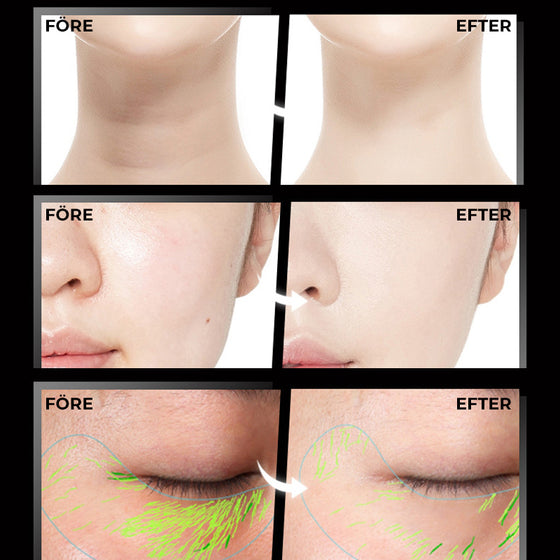 Lyftande och uppstramande Sonic Vibration Massager