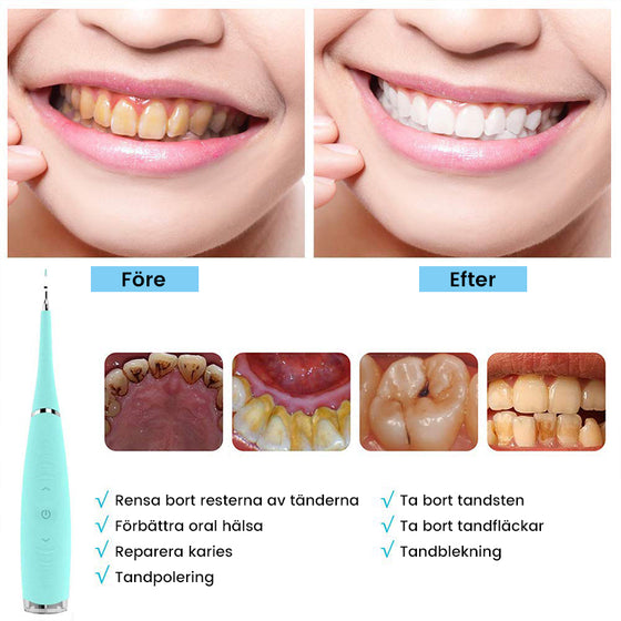 Ultraljud tandrengörare