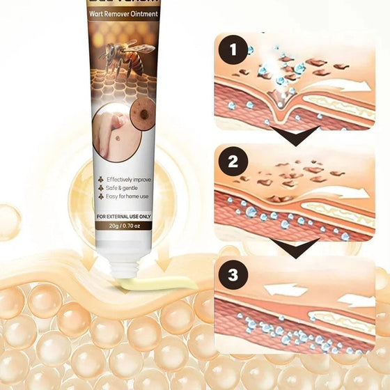 Anti-vårta/Hudflik kräm