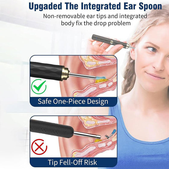 Smart visuell öronrensare med kamera