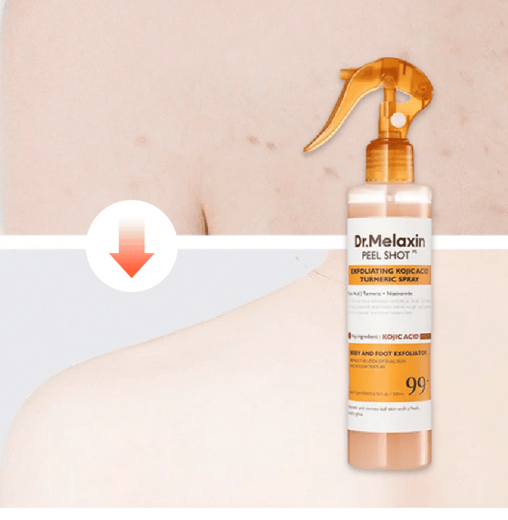 Keratin Care Kojic Acid Gurkmeja Spray