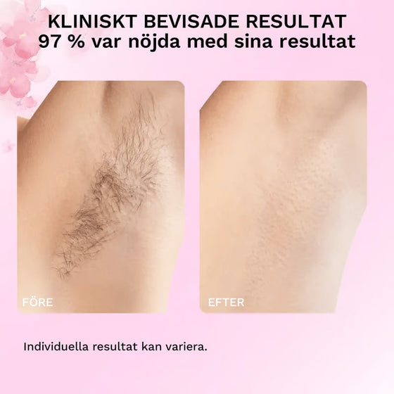 Cyperus Rotundus-olja för naturlig permanent hårreducering