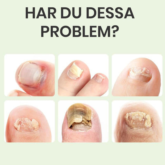 Nagelreparationsmagiska droppar