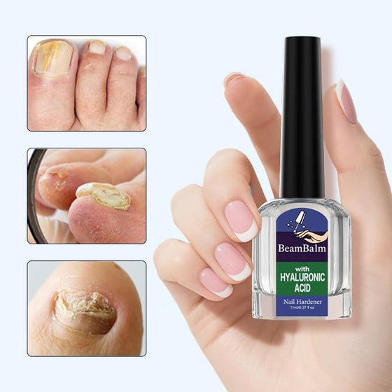 Lösning för svampdödande nagelreparation