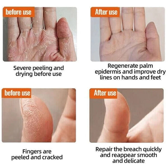 Vinter Anti-sprickbildning Frost