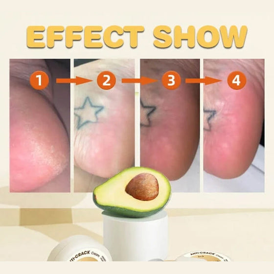 Vinter Anti-sprickbildning Frost