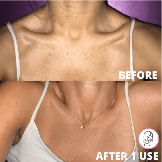 Exfolierande badhandskar